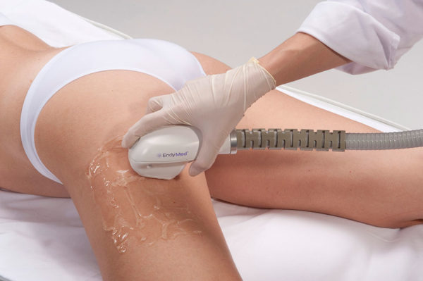 EndyMed corporal en Zaragoza