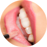 relleno de labios en Zaragoza