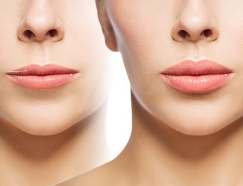 Labios más carnosos e hidratados